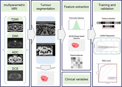 Radiomics Based on <mark class="highlighted">Multiparametric Magnetic Resonance Imaging</mark> to Predict Extraprostatic Extension of Prostate Cancer